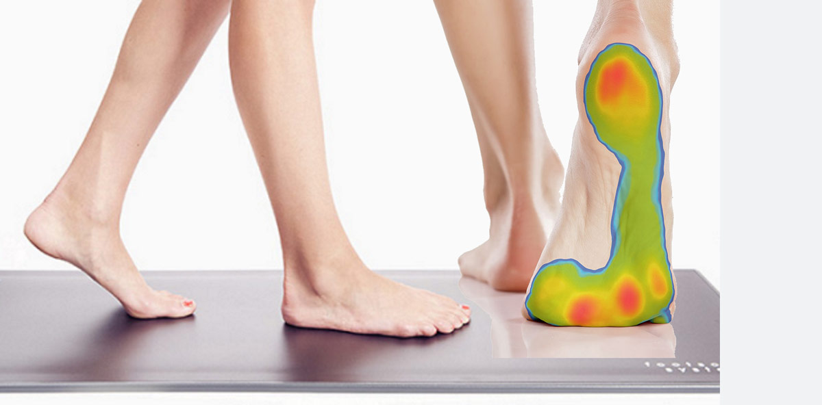 Footscan