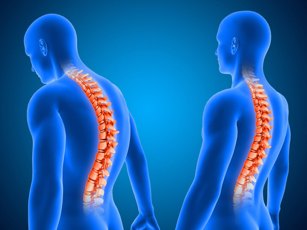 Posture Analysis - Sportify